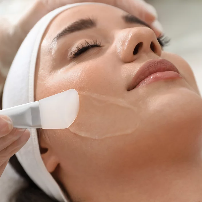 Chemical Peels